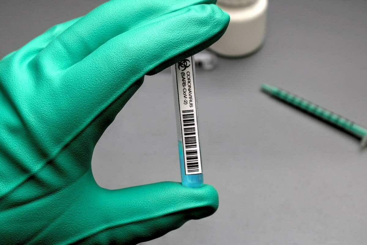 Os kits serão usados em rede com cerca de 30 laboratórios públicos, particulares e universitários