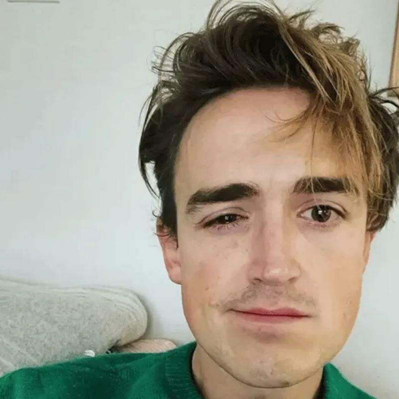 Tom Fletcher está tratando de inflamação no olho