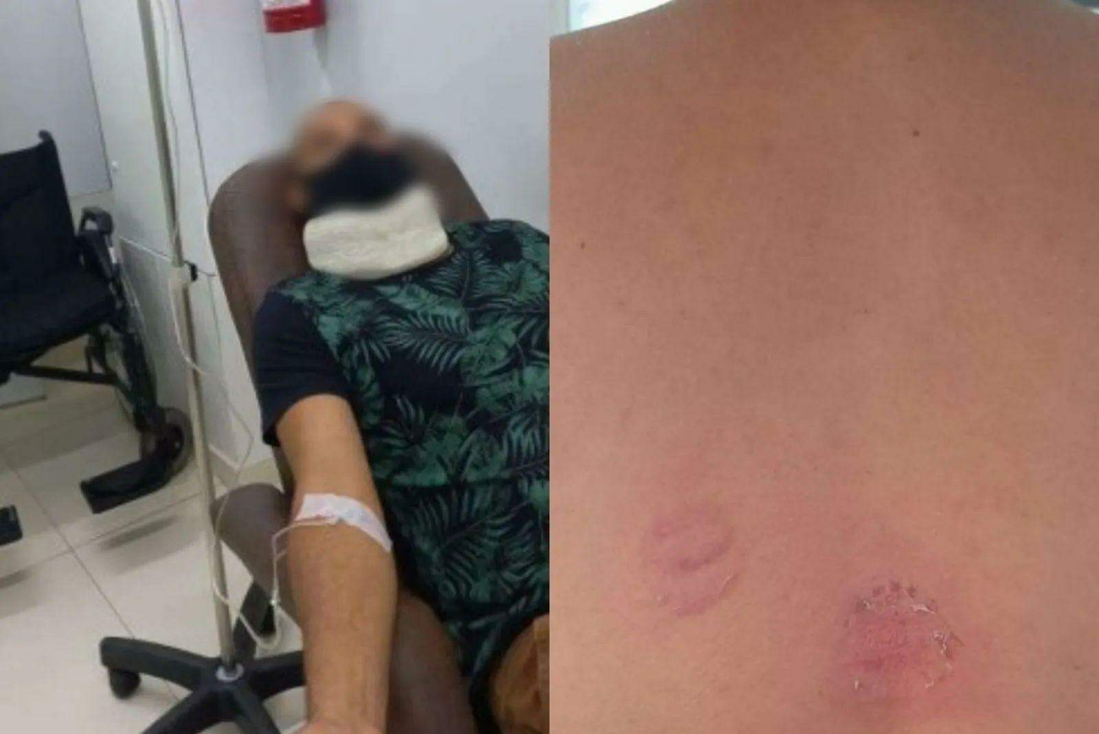 Vítima precisou usar colar cervical e ficou com marcas de mordida nas costas