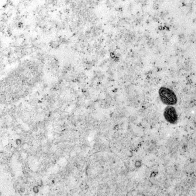 De acordo com o boletim, o Sudeste concentra a maior parte dos casos de mpox no país, 80,9% ou 821 do total