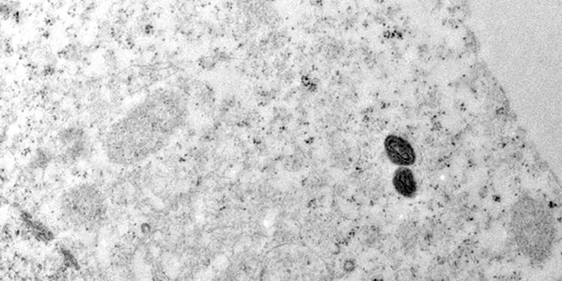 De acordo com o boletim, o Sudeste concentra a maior parte dos casos de mpox no país, 80,9% ou 821 do total