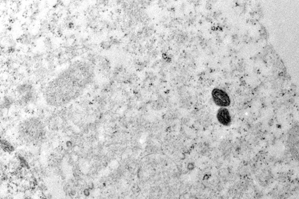 De acordo com o boletim, o Sudeste concentra a maior parte dos casos de mpox no país, 80,9% ou 821 do total