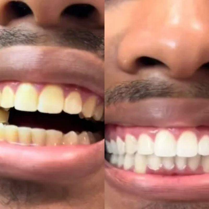 Internautas gravaram vídeos no TikTok mostrando o efeito milagroso do galho