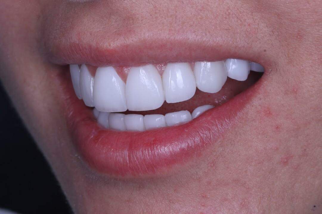 (Arquivo: EJL Odontologia e Estética)