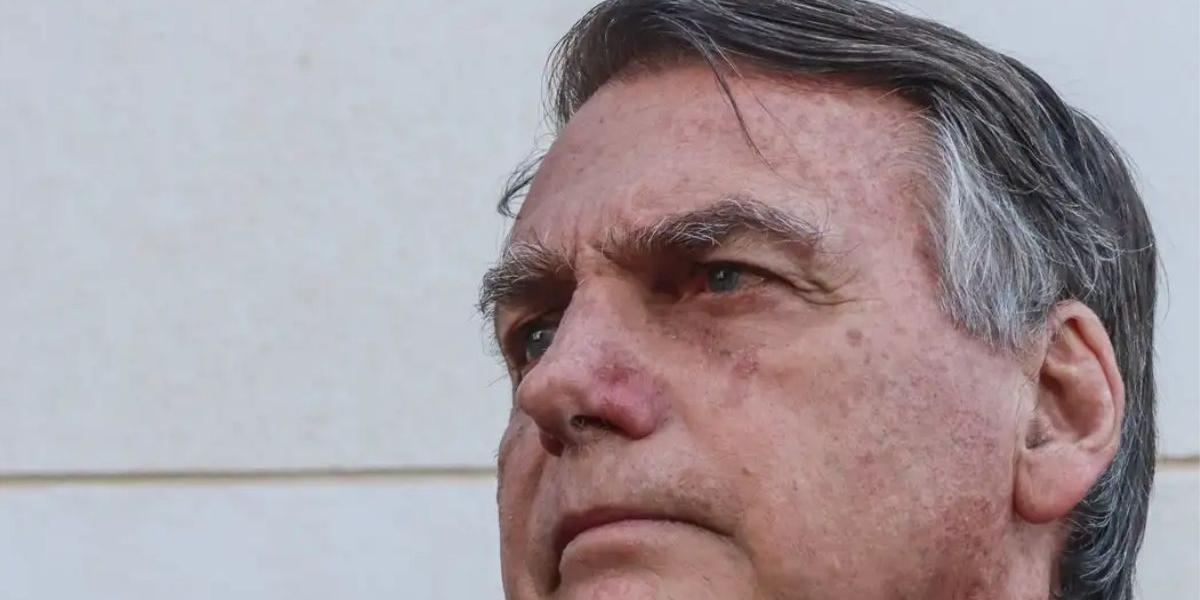 A defesa de Bolsonaro já informou ao STF que há indicação para o ex-presidente realizar cirurgia para tratar das dores no ombro direito
