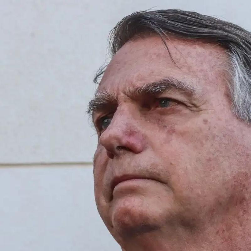Bolsonaro pede autorização a Moraes para fazer nova cirurgia