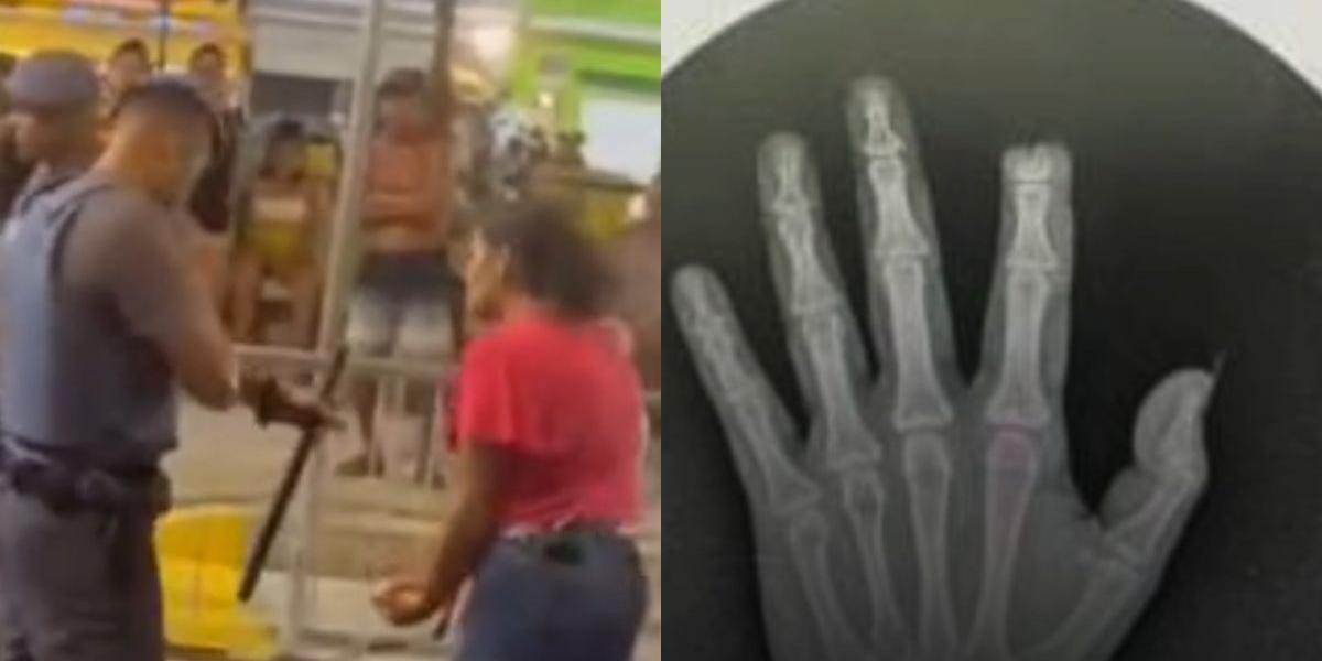 Vítima teve a ponta do dedo indicador direito arrancada; ela registrou um boletim de ocorrência contra o suposto agressor