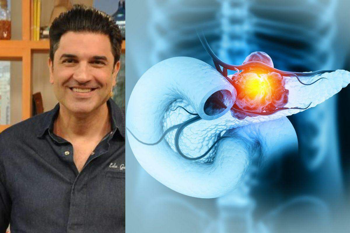 Câncer de pâncreas que atinge Edu Guedes é um dos mais mortais; entenda