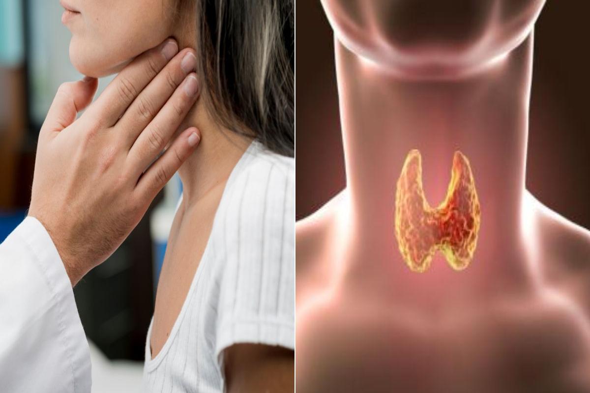Segundo o Ministério da Saúde, milhões de pessoas convivem com problemas na tireoide sem saber