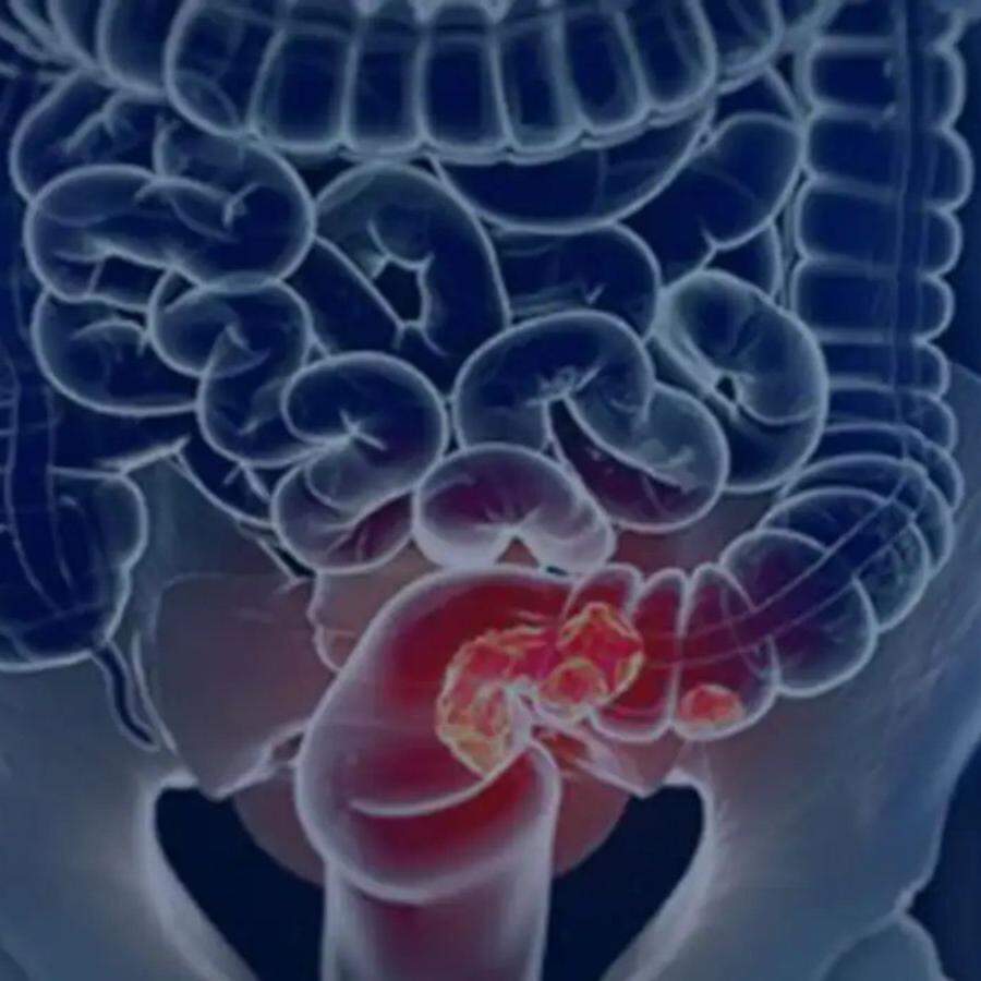 A Região Sudeste deverá ter um aumento de 34% nos óbitos e também irá concentrar o maior número absoluto de mortes.