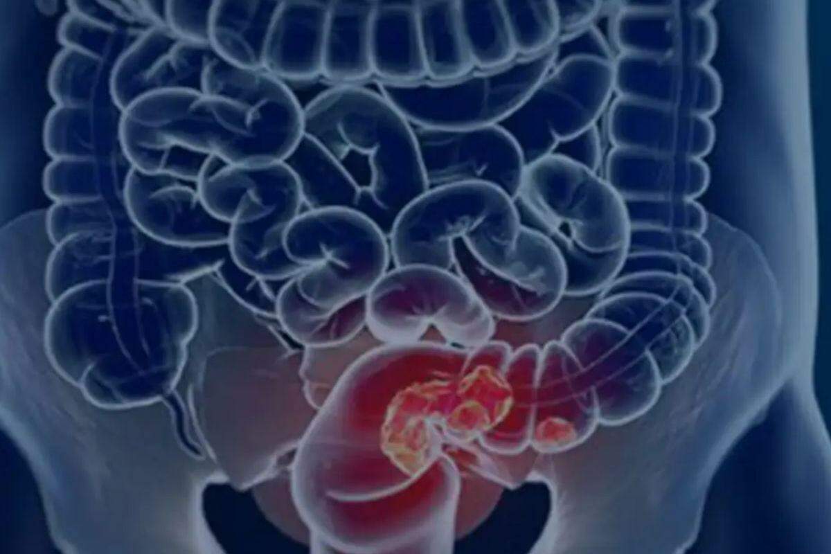 A Região Sudeste deverá ter um aumento de 34% nos óbitos e também irá concentrar o maior número absoluto de mortes.