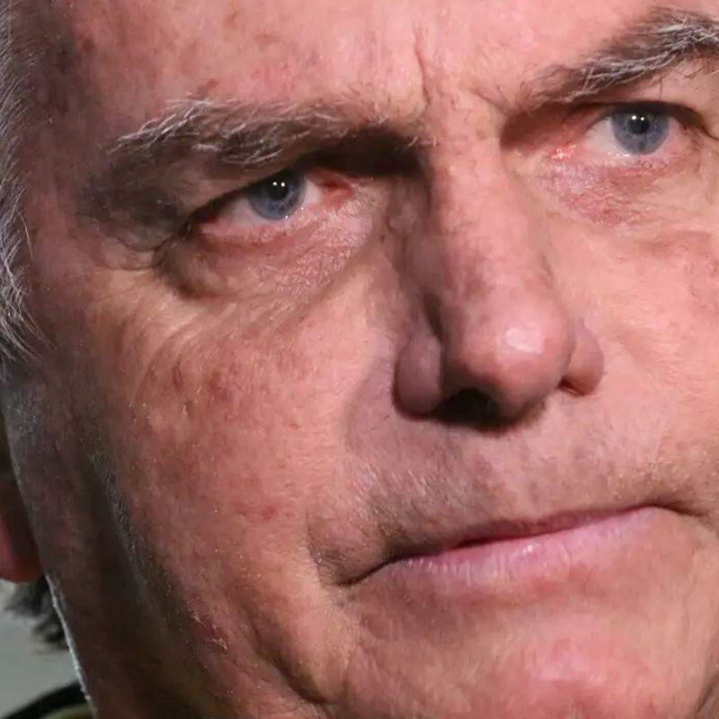 Bolsonaro apresenta boa evolução de cirurgia no ombro