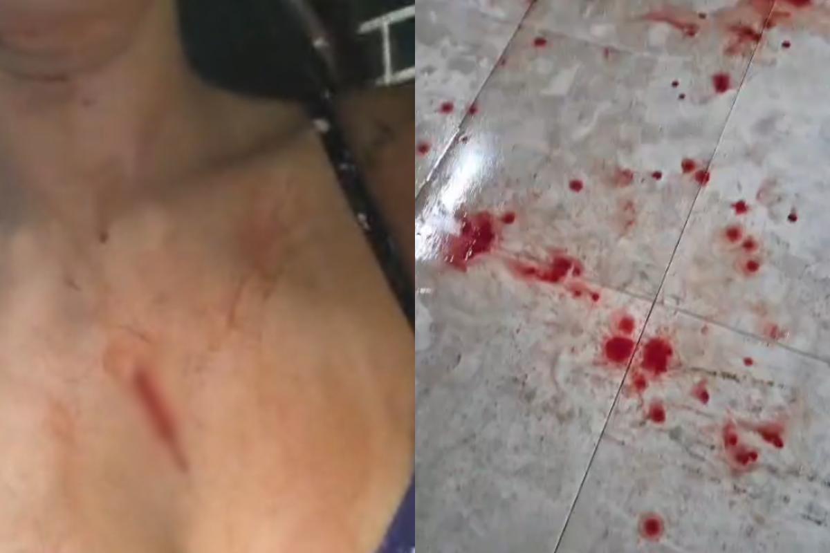Carla contou que a mulher chegou exaltada e que, ao se aproximar, puxou seu cabelo e a atingiu com um punhal de vidro em Praia Grande (Arquivo pessoal/ Carla Taize)