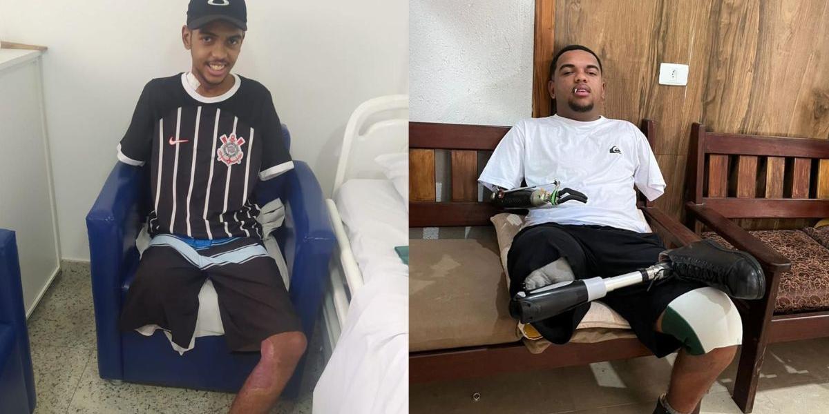Jovem que perdeu membros após descarga elétrica luta para conseguir prótese