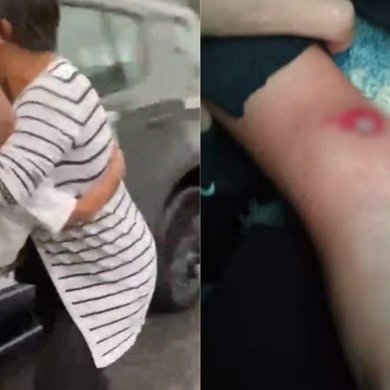 Menino de três anos é atropelada por viatura de PM ao sair de creche em Santos; VÍDEO