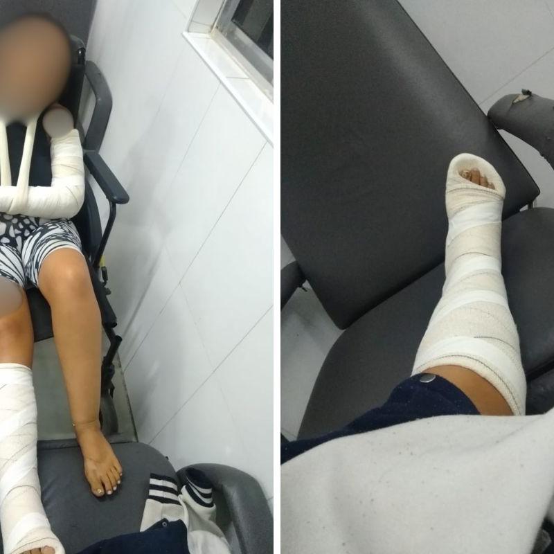 Mulher ficou ferida após ser agredida violentamente pelo companheiro e irmãs dele