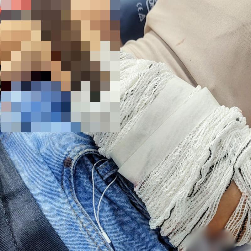 Mulher levou um golpe de faca