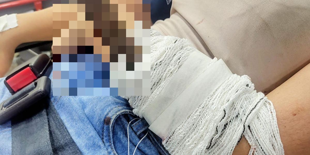 Mulher levou um golpe de faca