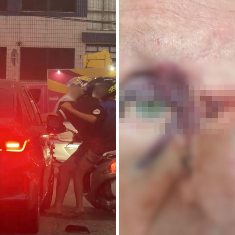 O motociclista socou o idoso em Praia Grande; o homem de 74 anos sofreu várias fraturas no rosto