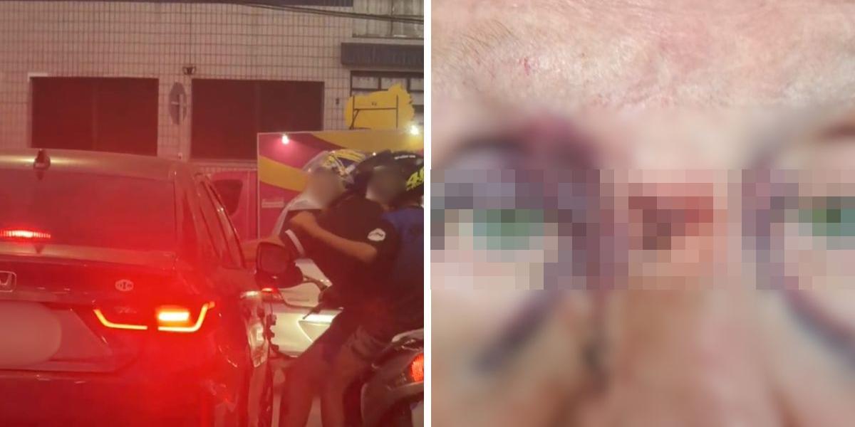 O motociclista socou o idoso em Praia Grande; o homem de 74 anos sofreu várias fraturas no rosto