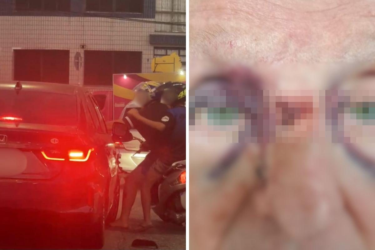 O motociclista socou o idoso em Praia Grande; o homem de 74 anos sofreu várias fraturas no rosto