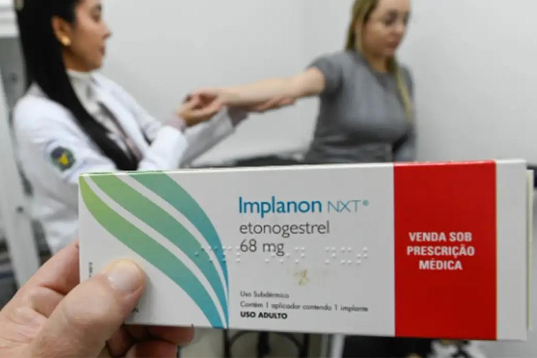 Após esse período, o implante deve ser retirado e, se houver interesse, um novo implante pode ser inserido imediatamente