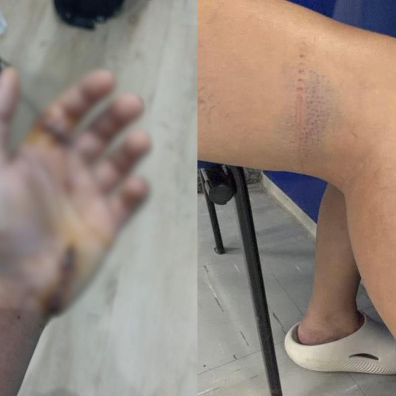 Enteado teve ferimentos na mão; mulher sofreu ferimentos pelo corpo