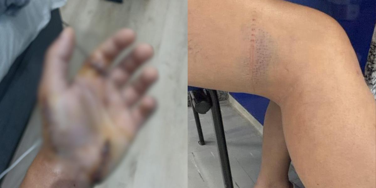 Enteado teve ferimentos na mão; mulher sofreu ferimentos pelo corpo