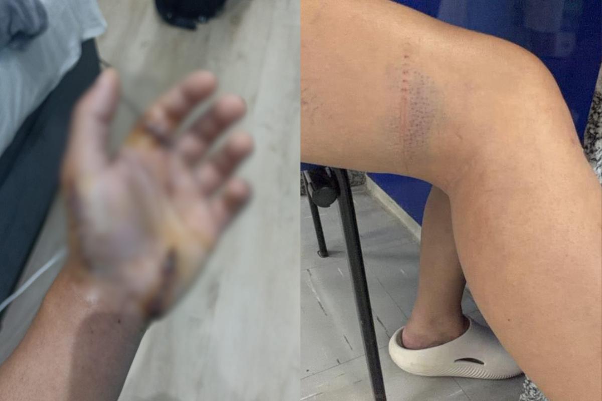 Enteado teve ferimentos na mão; mulher sofreu ferimentos pelo corpo
