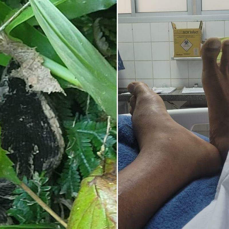 Leandro teve ajuda do Instituto Butantan e IA para identificar espécie certa de cobra que o atacou