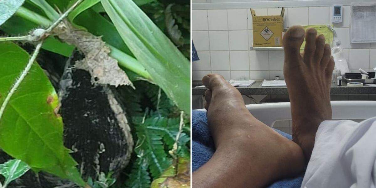 Leandro teve ajuda do Instituto Butantan e IA para identificar espécie certa de cobra que o atacou