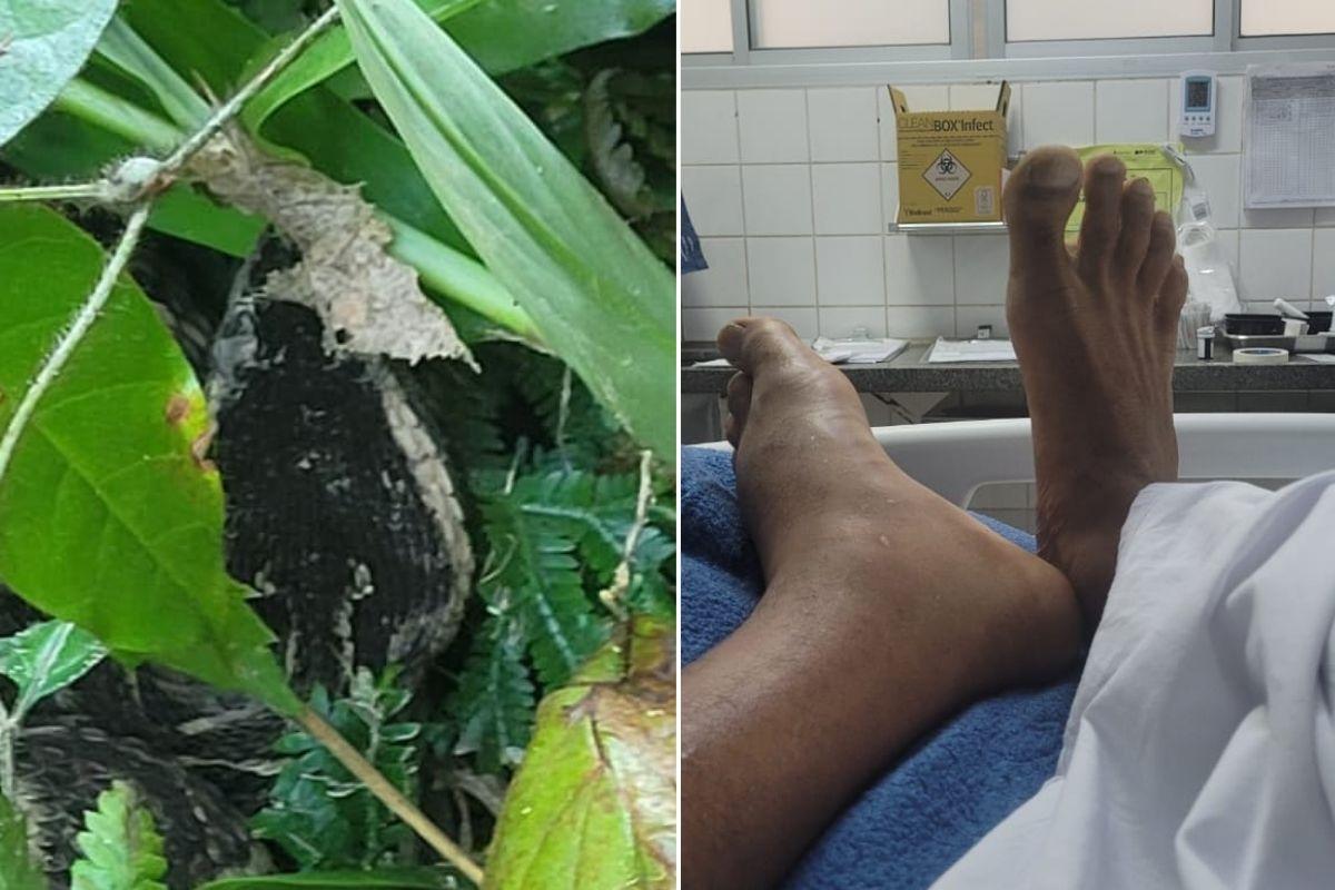 Leandro teve ajuda do Instituto Butantan e IA para identificar espécie certa de cobra que o atacou