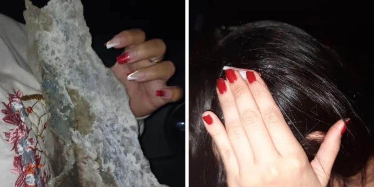 Mulher foi atingida na cabeça por bloco de concreto de 10 kg enquanto fazia a travessia de catraia entre Santos e Guarujá