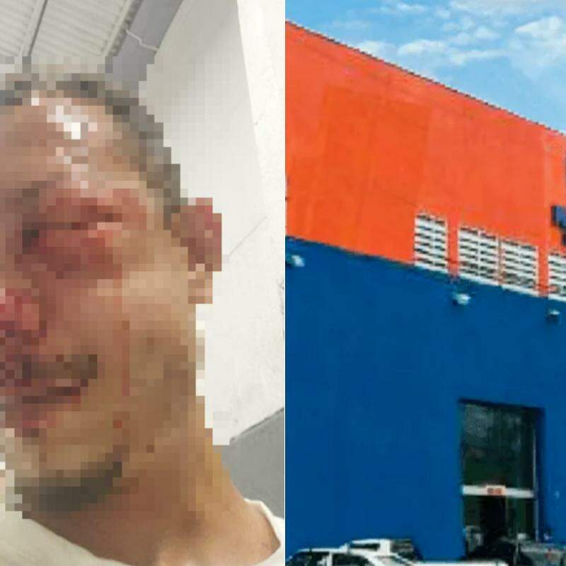 Kauê teve diversas lesões após as agressões; caso é investigado