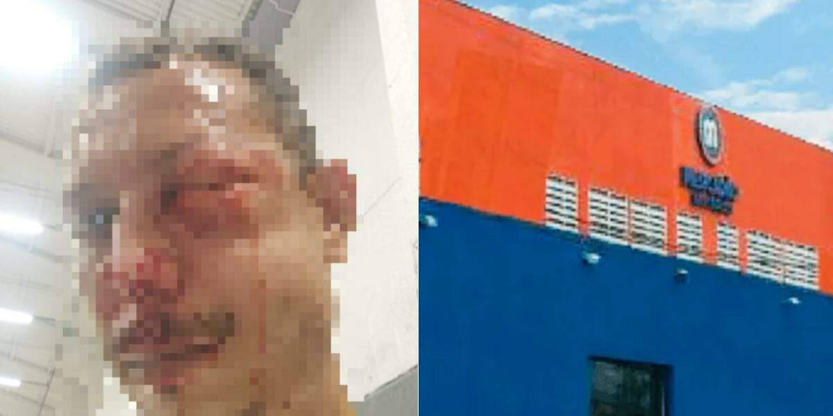 Kauê teve diversas lesões após as agressões; caso é investigado