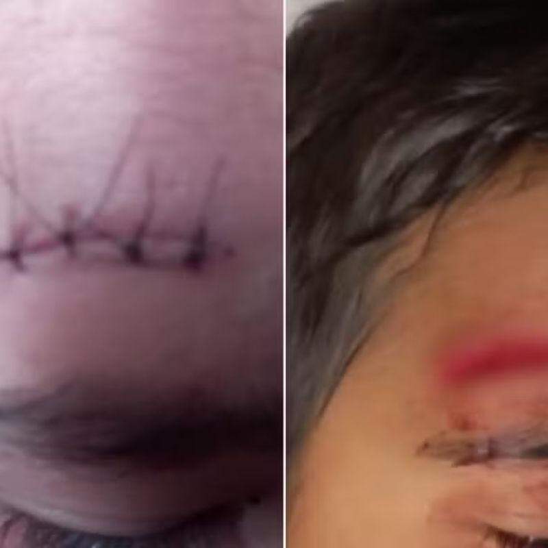 Menino teve um corte na testa e precisou levar pontos