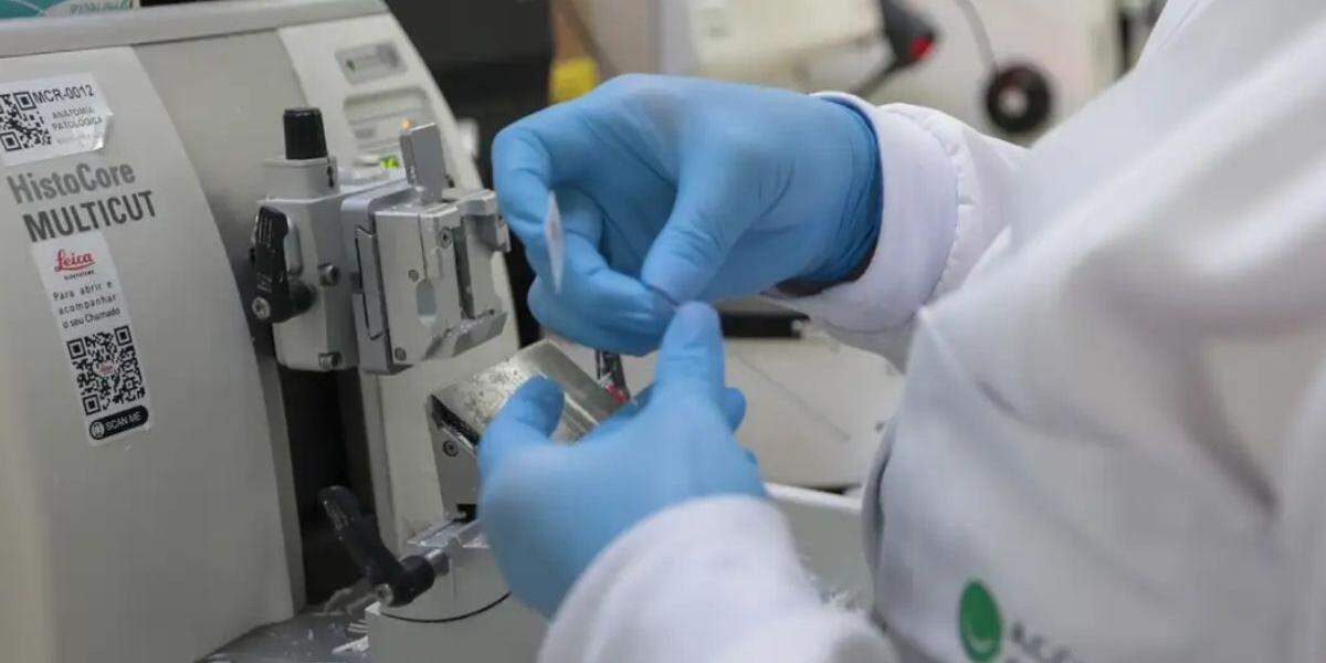 SUS inclui nova terapia para pacientes adultos com leucemia mieloide