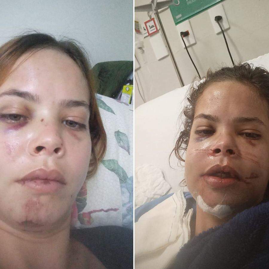 Gabriela passou por uma cirurgia de oito horas após o acidente