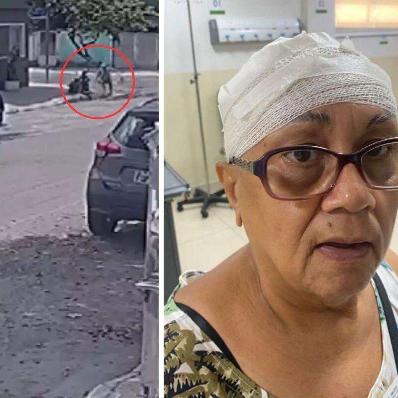Maria de Lourdes sofreu um corte na cabeça após escorregar em uma obra inacabada em Santos