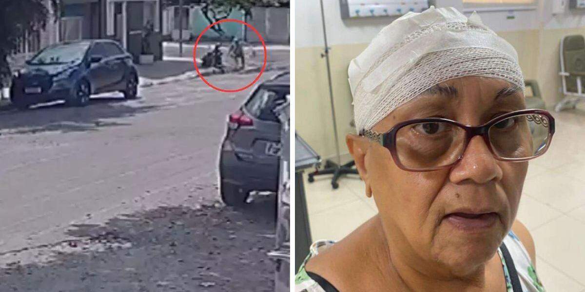 Maria de Lourdes sofreu um corte na cabeça após escorregar em uma obra inacabada em Santos