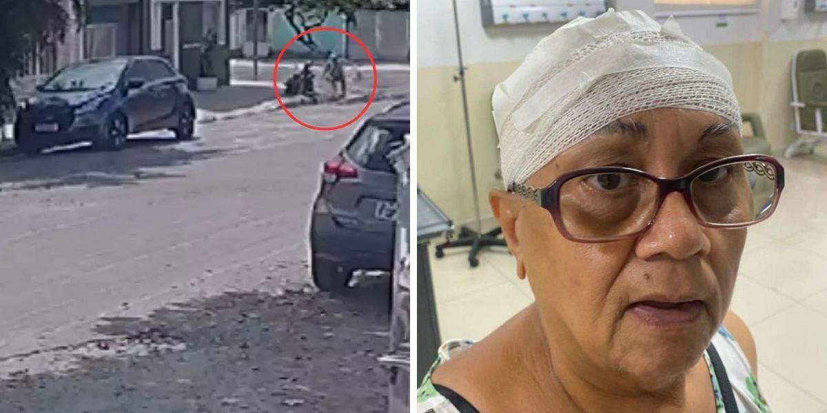 Maria de Lourdes sofreu um corte na cabeça após escorregar em uma obra inacabada em Santos