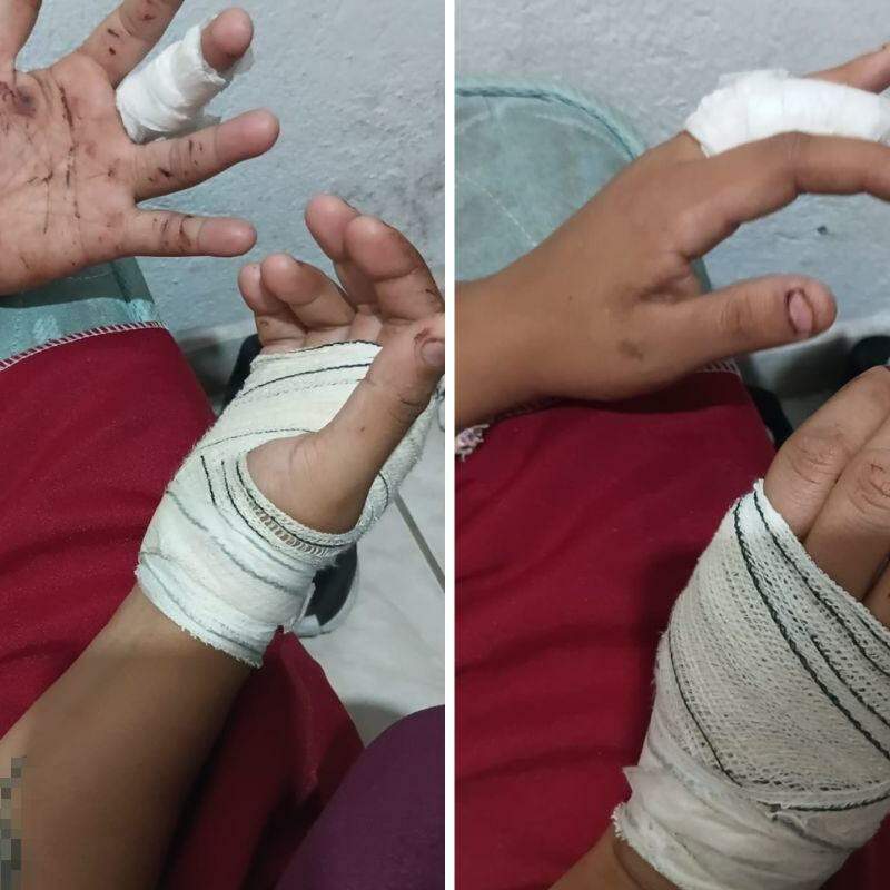 Mulher de 28 anos sofreu cortes nas mãos após se defender de golpes de faca
