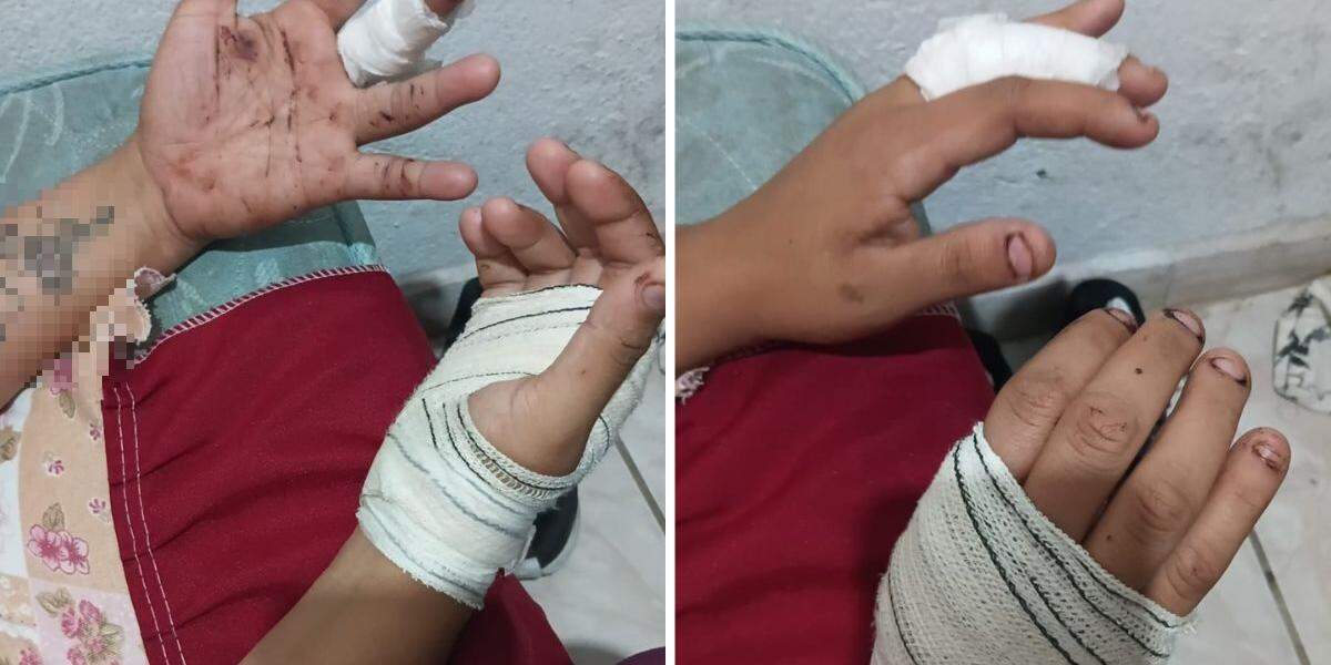 Mulher de 28 anos sofreu cortes nas mãos após se defender de golpes de faca