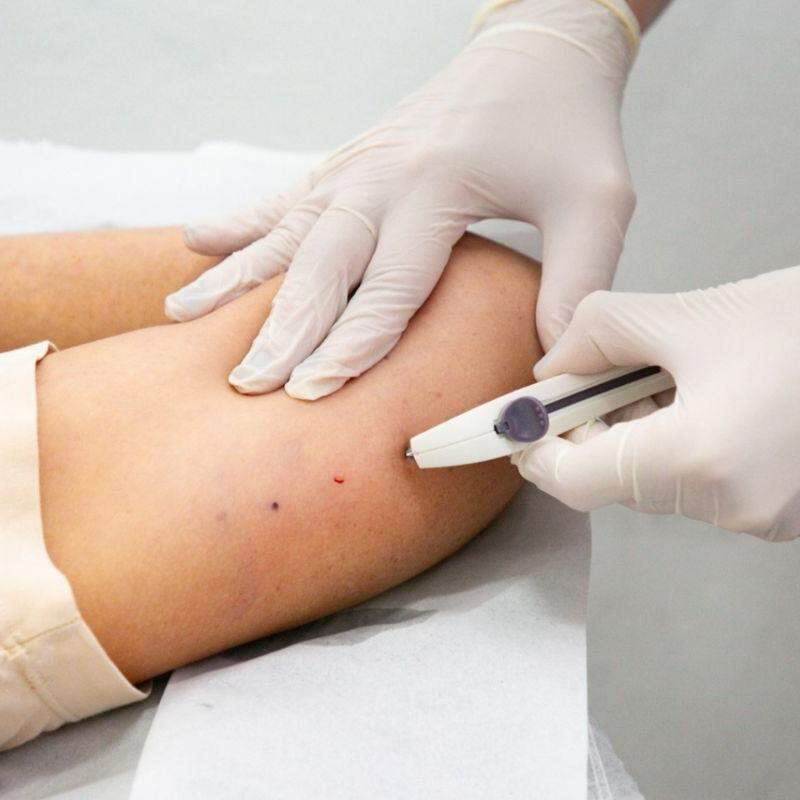 Cidade faz implantes de Implanon, remédio para prevenir gravidez. Foco: evitar gestações na adolescência