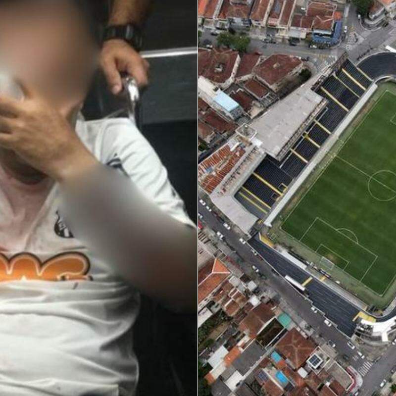 Torcedor perdeu o olho após confusão em 2017, nos arredores da Vila Belmiro