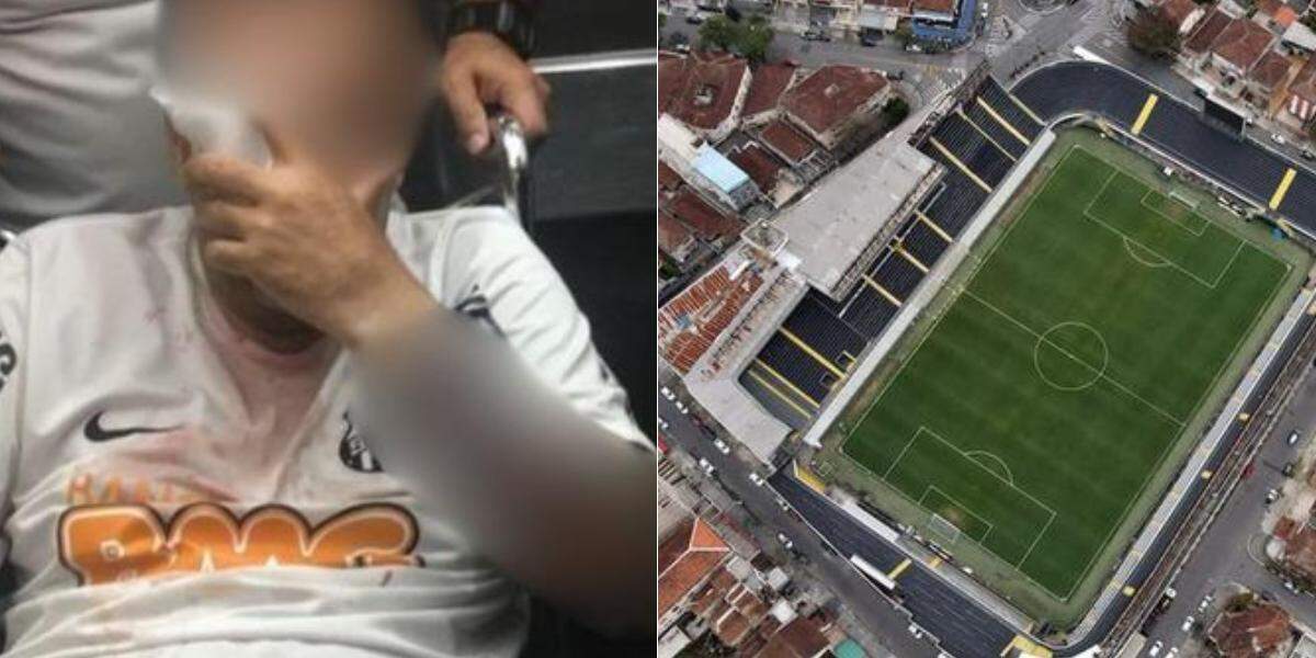 Torcedor perdeu o olho após confusão em 2017, nos arredores da Vila Belmiro
