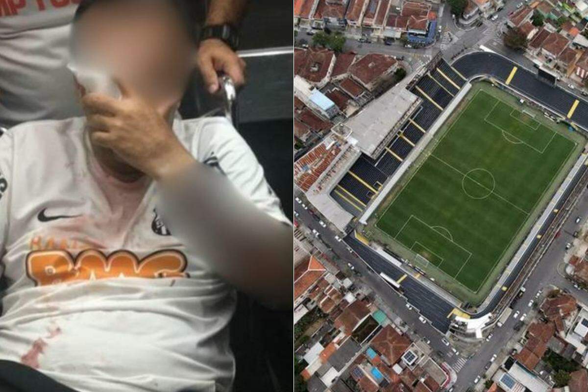 Santos e Governo de SP são condenados a indenizar torcedor que perdeu olho