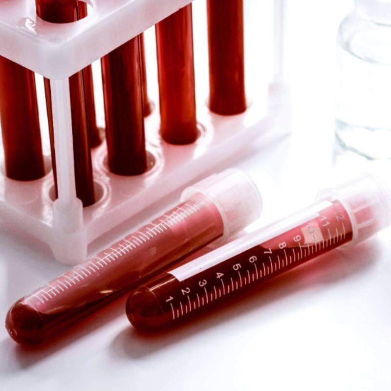 São oferecidos 1,3 mil testes para identificação de doenças