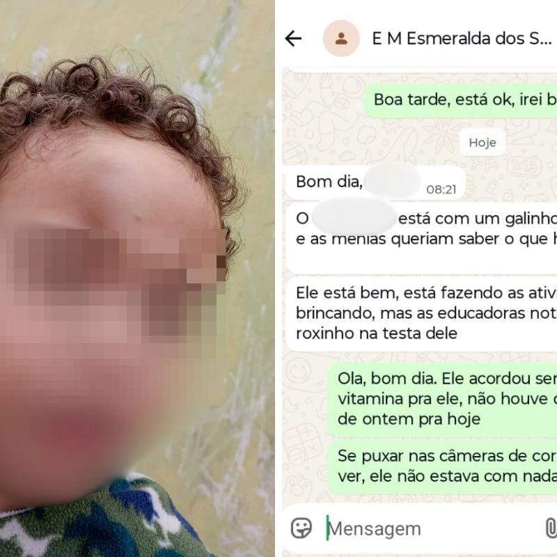 Creche de Praia Grande mandou mensagem para a mãe avisando sobre o machucado do filho