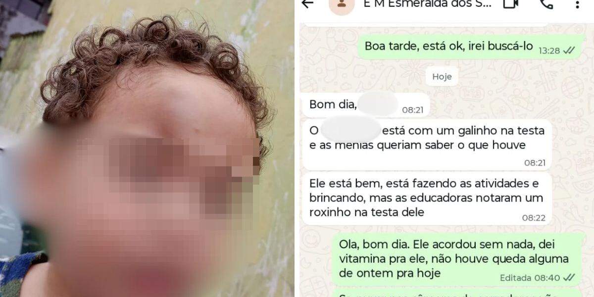 Creche de Praia Grande mandou mensagem para a mãe avisando sobre o machucado do filho